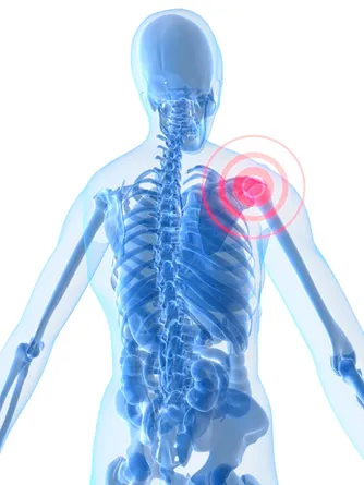 shoulder-pain