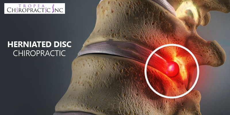 herniated disc chiropractic